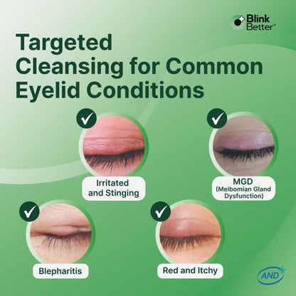 BetterLids Eyelid Cleansing Gel