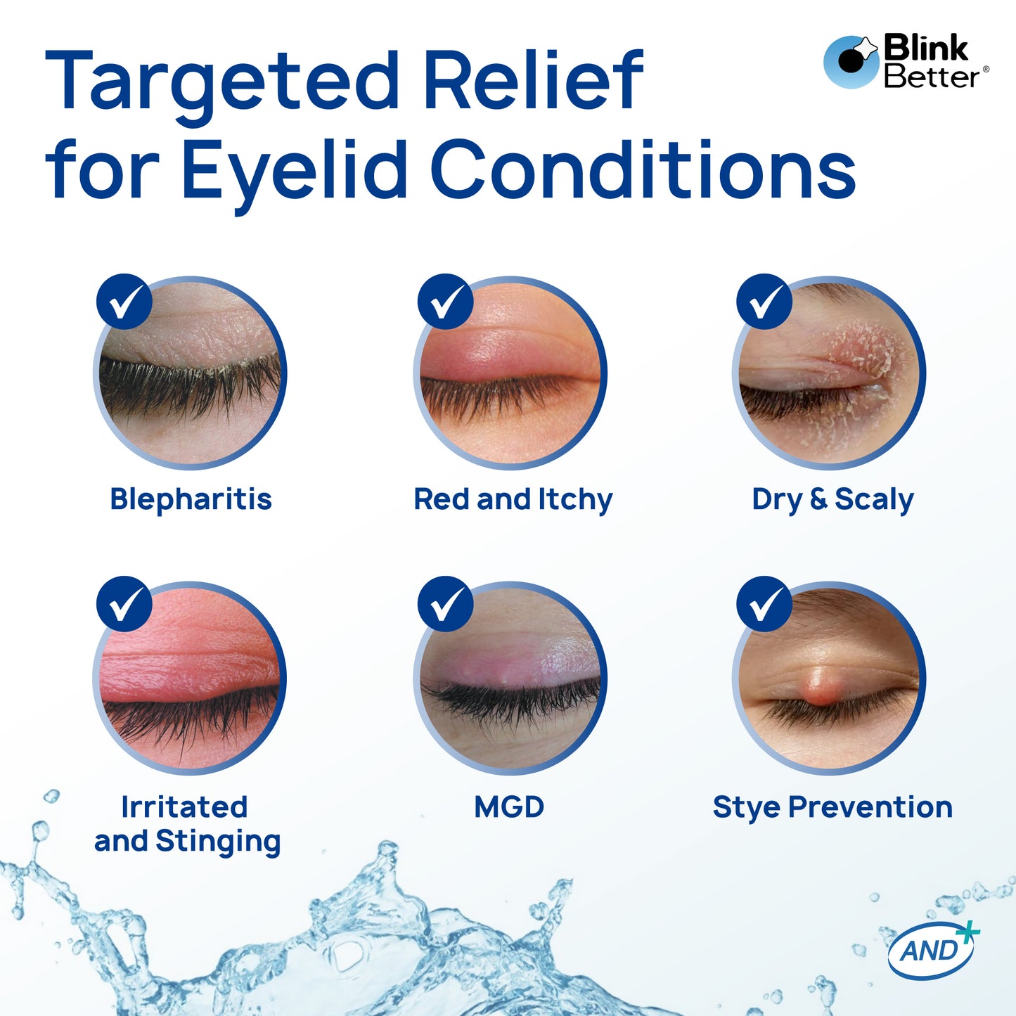 BetterLids Hypochlorous Spray - Instant Eyelid Relief